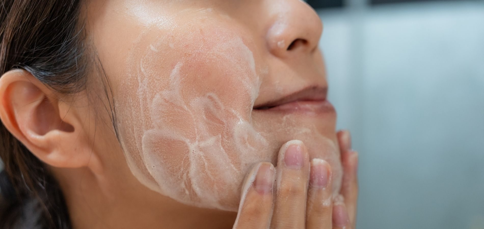 Melhor Sabonete para Melasma Melhor Sabonete para Melasma