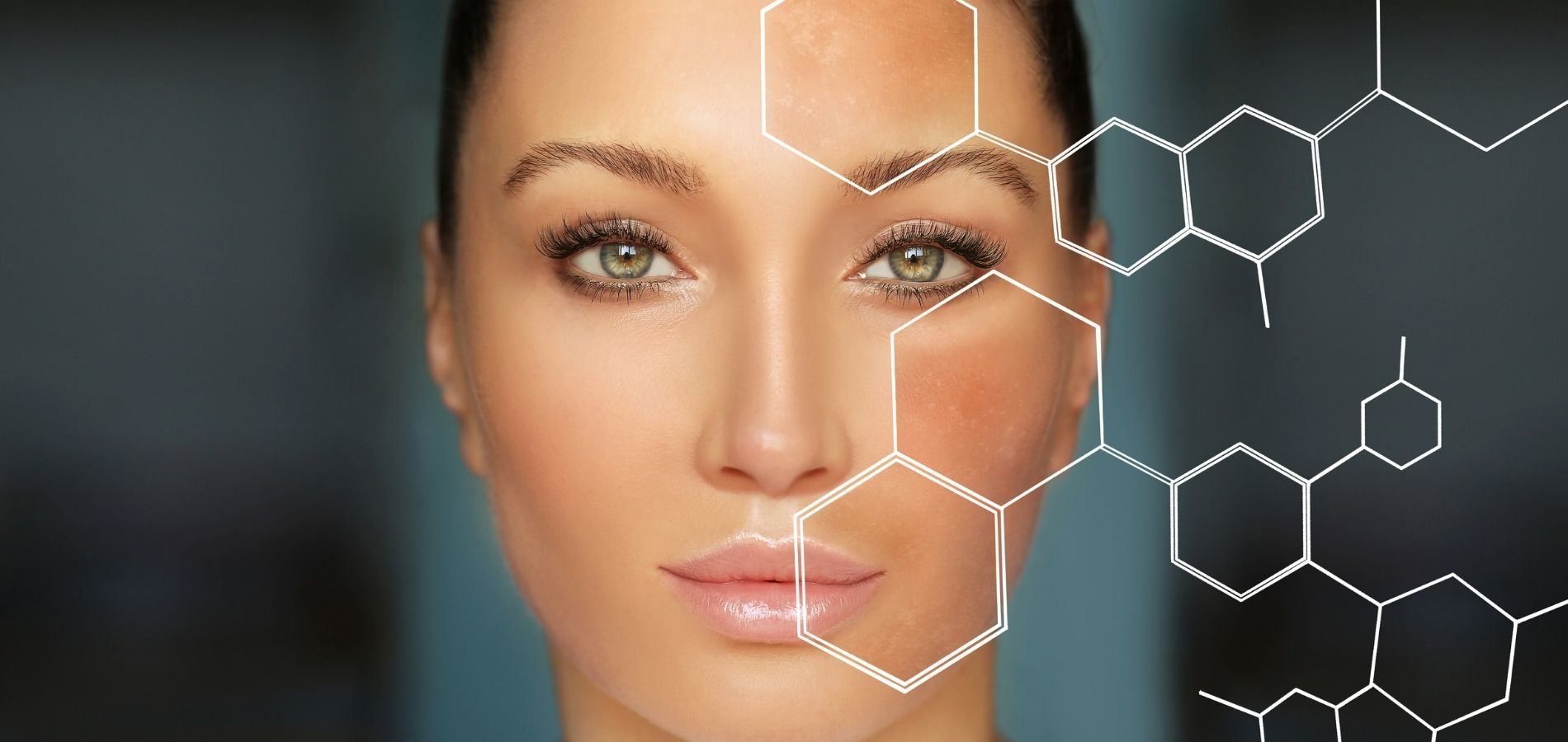 Dermocosméticos para Tratar o Melasma O Que São, Como Agem e Quais os Melhores Ativos Dermocosméticos para Tratar o Melasma O Que São, Como Agem e Quais os Melhores Ativos