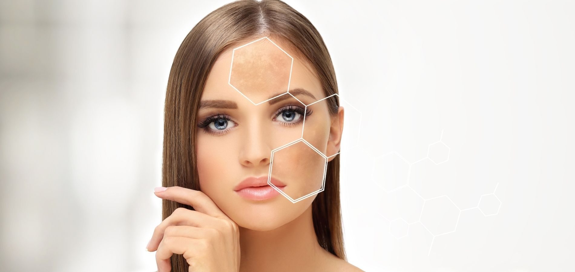 Melhor Produto para Melasma Melhor Produto para Melasma
